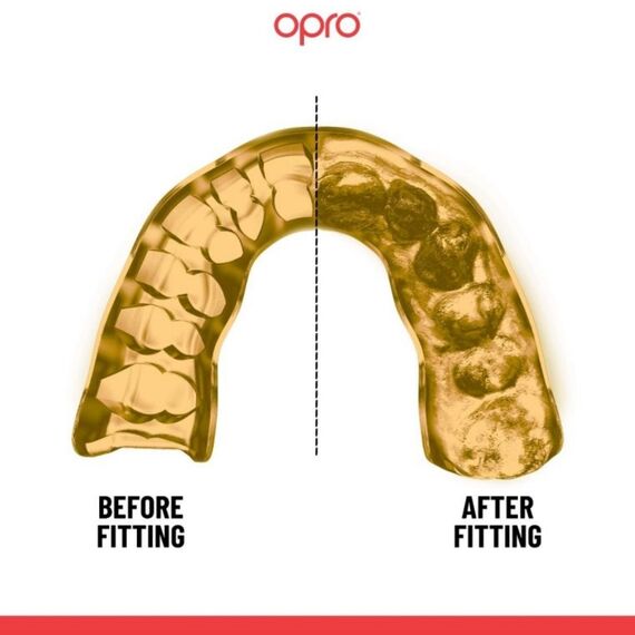 Instant Custom Fit Mouthguard – Ideal for Sports, Size: One Size, Colour: Gold, 2 image