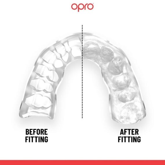 Instant Custom Fit Mouthguard – Ideal for Sports, Size: One Size, Colour: Silber, 2 image