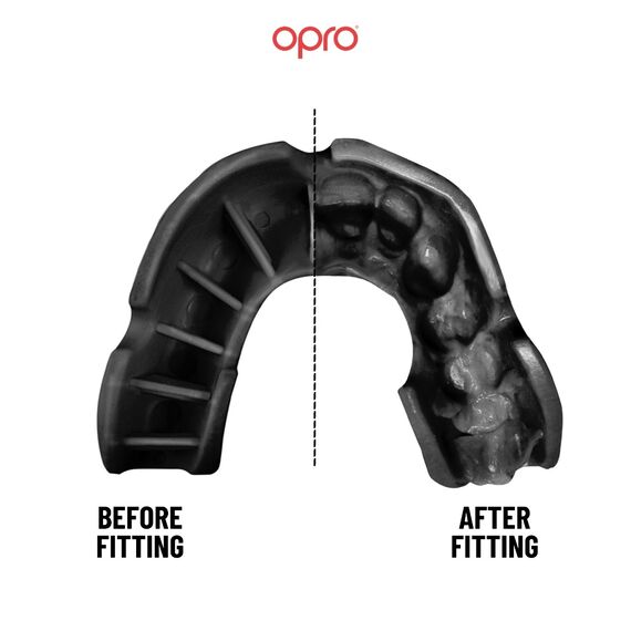 OPRO Bronze: Essential Contact Sports Protection, Colour: Schwarz, 2 image