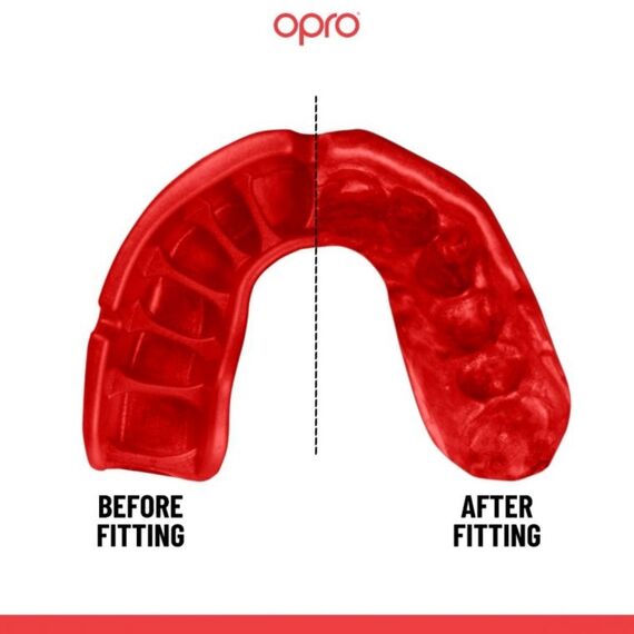 OPRO Self-Fit Platinum: Advanced Protection for Contact Sports, Size: One Size, Colour: Schwarz, 2 image