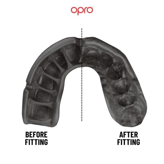 OPRO Self-Fit Platinum: Advanced Protection for Contact Sports, Size: One Size, Colour: Rot, 2 image