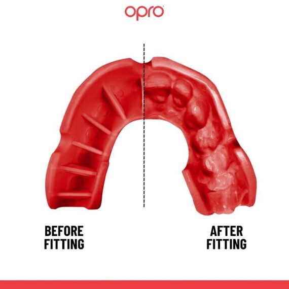 OPRO Silver: Match Protection for Contact Sports, Size: One Size, Colour: Schwarz, 2 image
