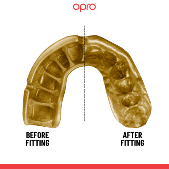 OPRO Gold : Protection de niveau compétition pour sports de contact, Taille: Taille unique, Couleur: Noir, 5 image