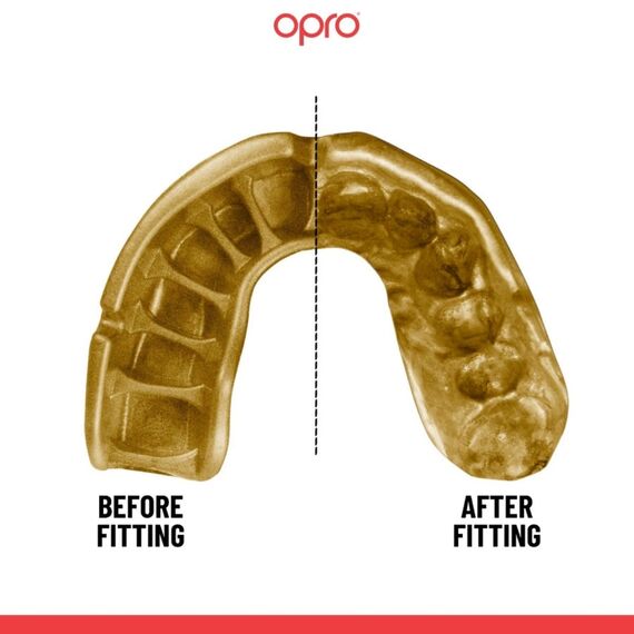 Mundschutz OPRO Self-Fit Gold Kinder, Bekleidungsgrösse: One Size, Farbe: Transparent, 2 image