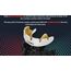 OPRO Braces Mouthguard: Optimal Protection for Braces Wearers, Colour: Gold, 2 image