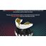 Paradenti Instant Custom Fit OPRO Jaws – Rosso/Bianco/Oro, Taglia: Taglia unica, Colore: Rosso, 2 image